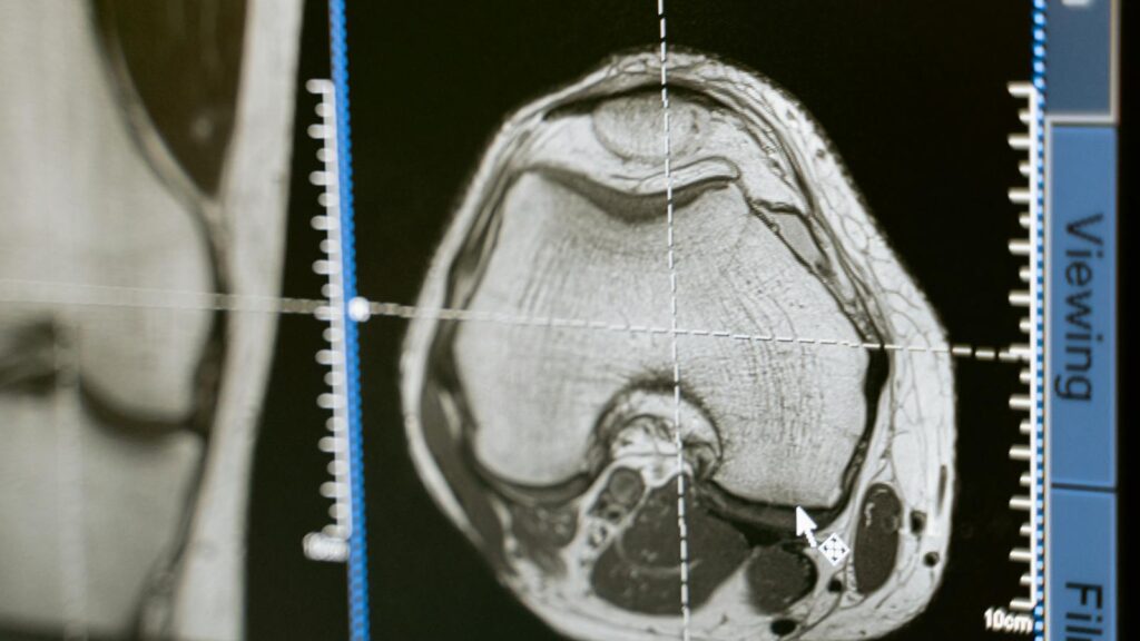 MRI scan displayed on a medical monitor, showcasing diagnostic medical imaging technology.