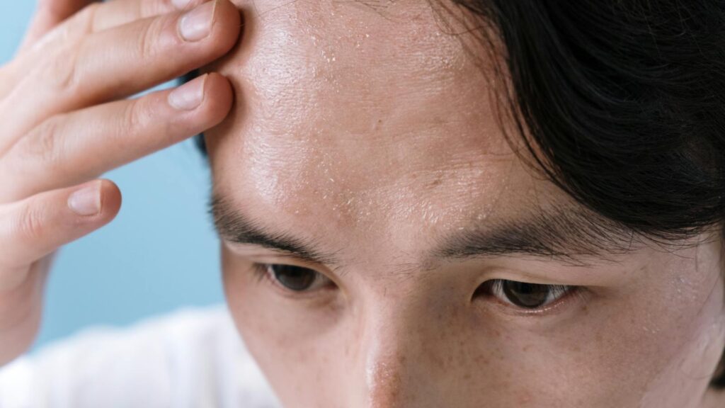 Close-up of a man with sweat on his forehead, touching it with his hand, conveying stress or illness.